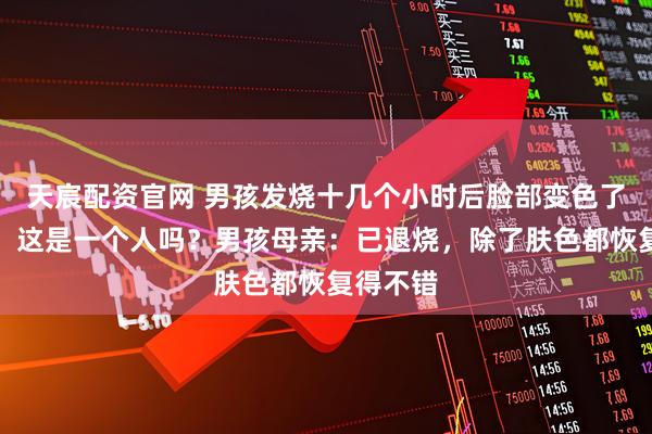 天宸配资官网 男孩发烧十几个小时后脸部变色了！网友：这是一个人吗？男孩母亲：已退烧，除了肤色都恢复得不错